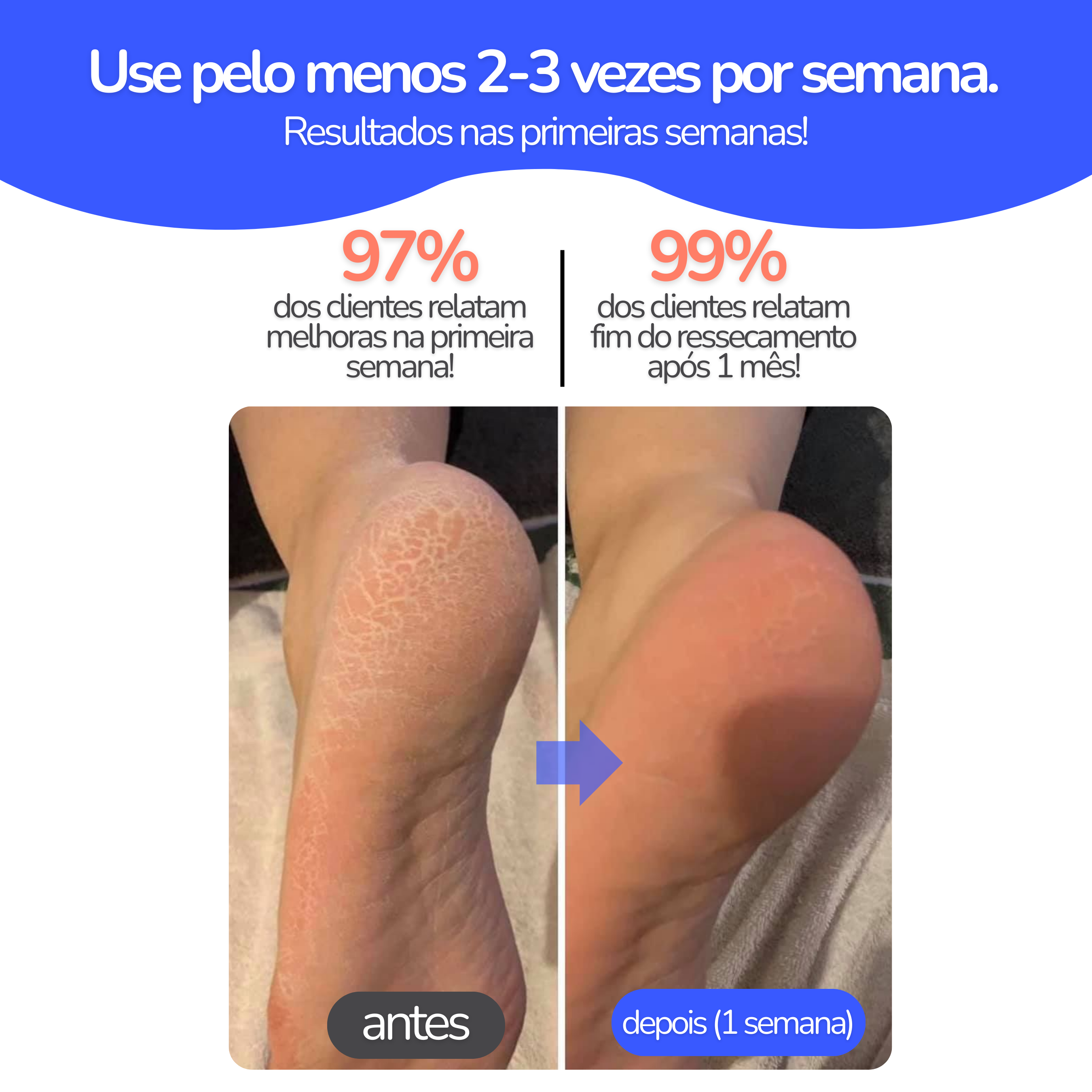 Kit com 2 pares Meia HidraPé® (Compre 1 & Leve 2 Pares)